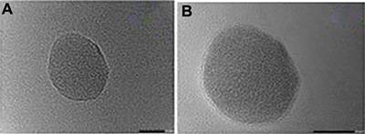 Inhalable dry powder nano-formulations: advancing lung disease therapy-a review